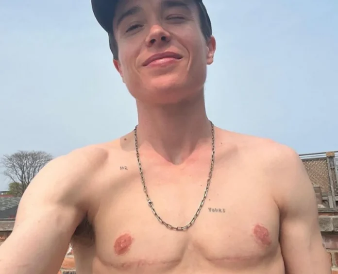 Elliot Page celebrates his ‘transjoy’ with topless snap showing surgery scars