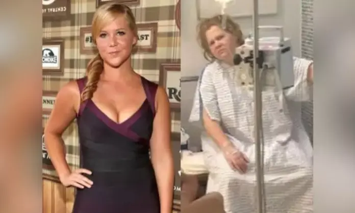 Amy Schumer posts image of herself hooked to an IV drip to warn women in 20s